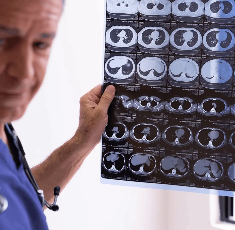 Radiologist examining scans