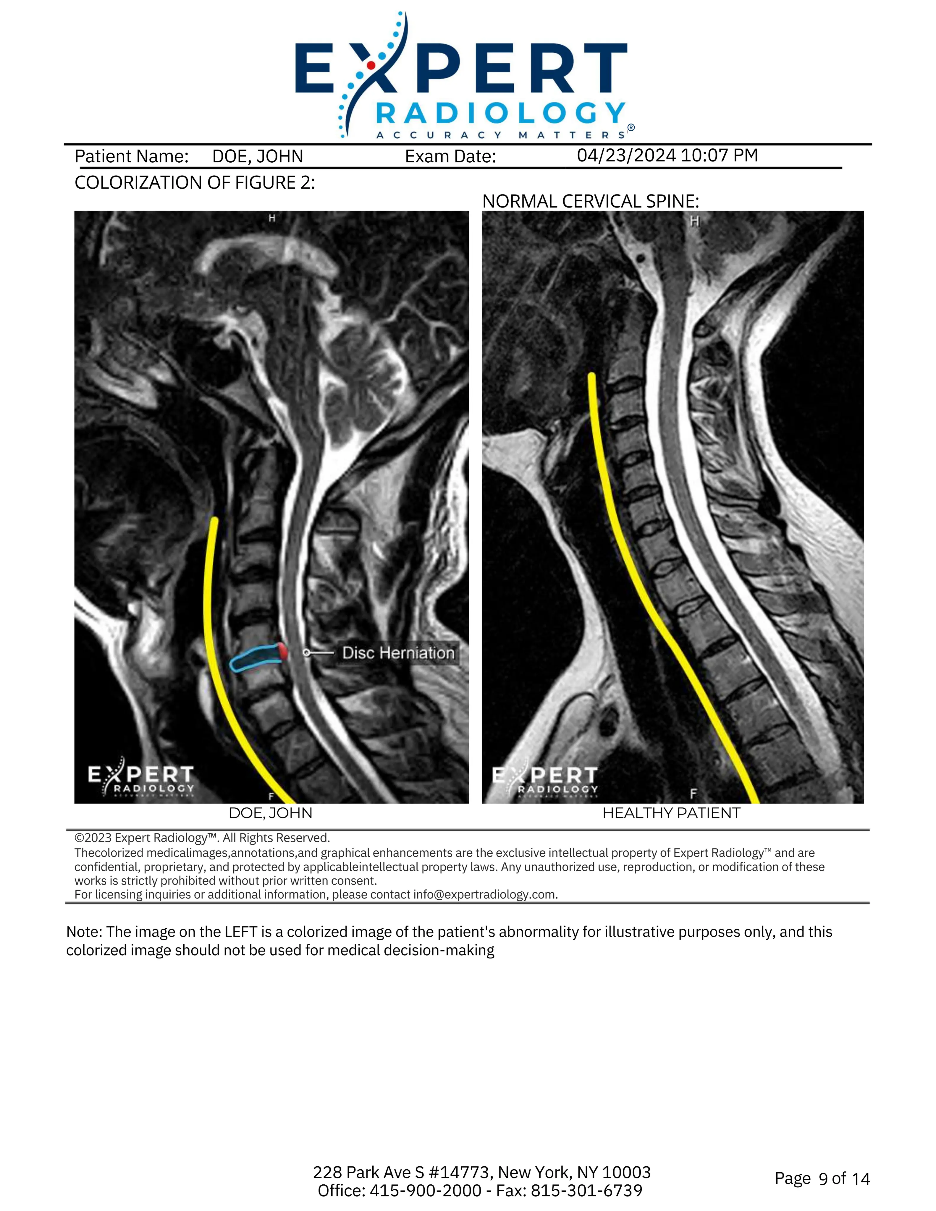 Key images with color-coded visuals