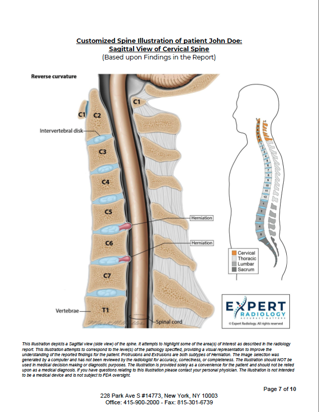 Spine anatomy illustration
