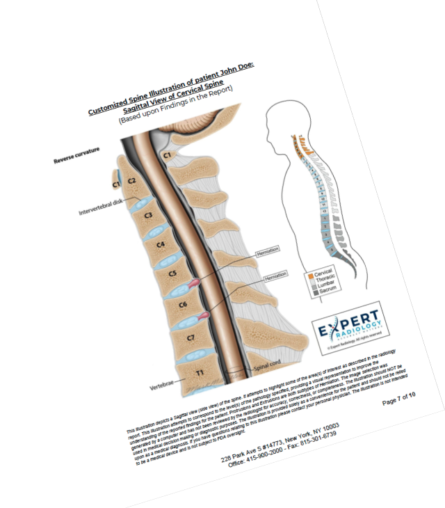 Expert Radiology sagittal spine report with anatomical illustration