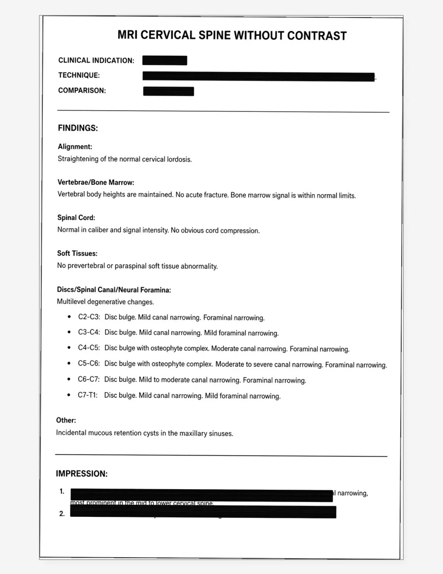 Traditional C-spine V1 radiology report — text only, photocopy style with redactions