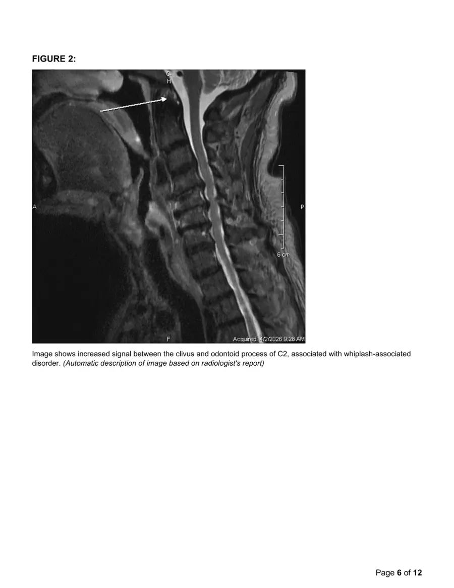 Page 6: Figure 2 MRI sagittal view with annotation arrow