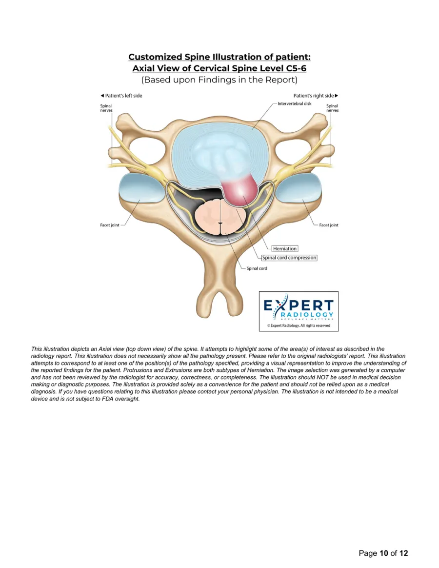 PrecisionPlus v3™ report page 10: Axial Illustration at Level