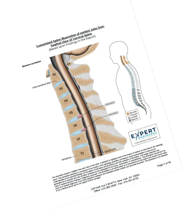 Expert Radiology Report Sample - Front
