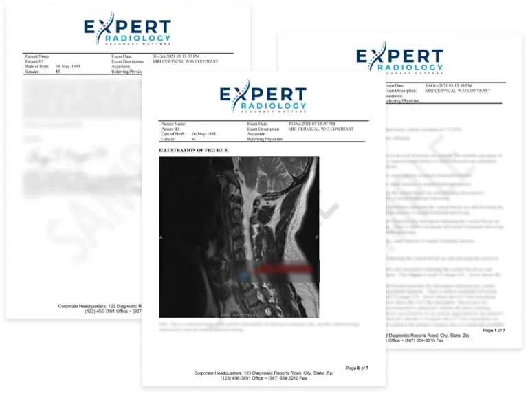 Expert Radiology Report Thumbnail Main